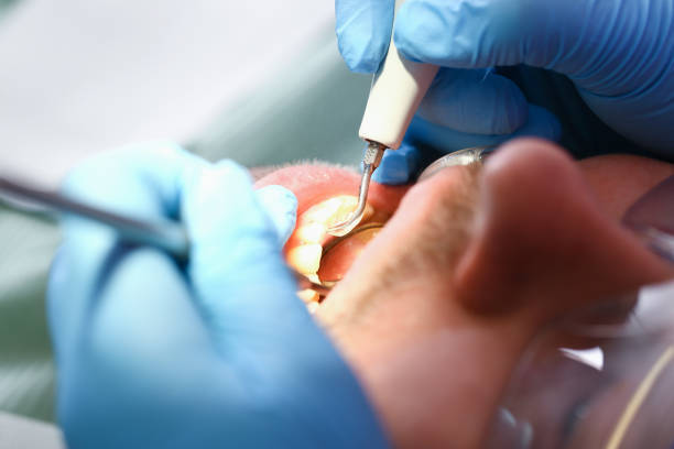 Best Emergency Orthodontic Repairs in Squirrel Mountain Valley, CA